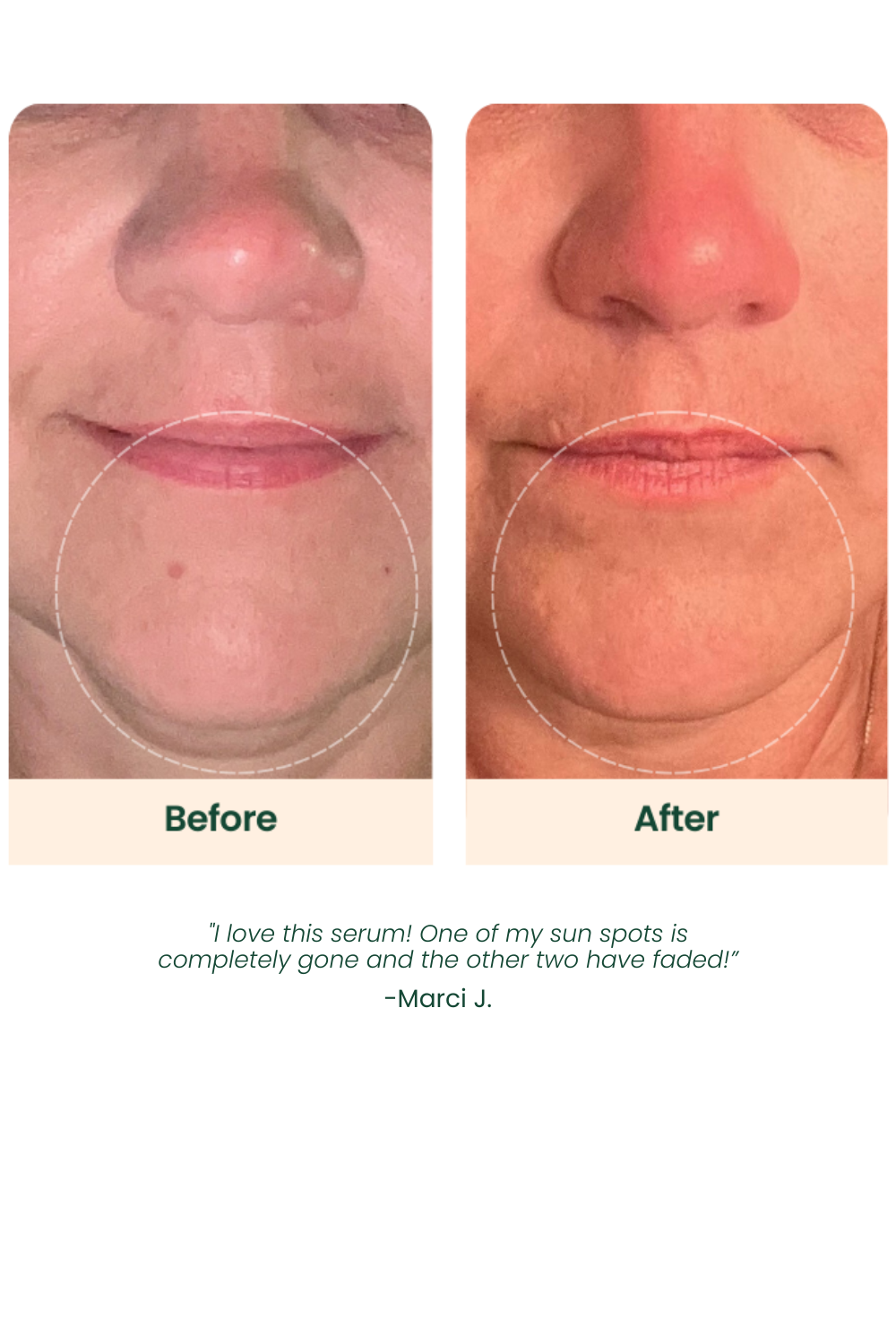 vitamin c serum on lips before and after The unique formatcombining the portability of a stick with the effectiveness of vitamin Chas been particularly appealing to those who appreciate its ease of use and non ONHAND LBLS Vitamin C